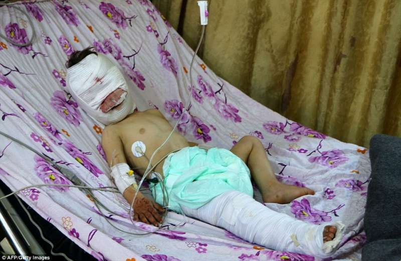 「我在這…」　敘利亞發生空襲　男童親吻受重傷的妹妹照片被瘋傳