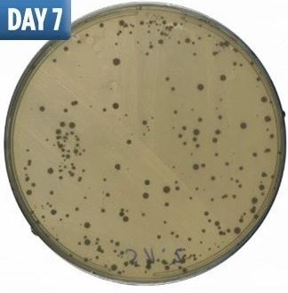 不洗床單「滿滿細菌陪你睡」　大學研究公開「細菌滋生圖」秒懂多髒