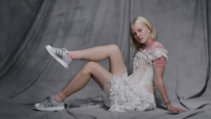 瑞典女模拍Adidas廣告「沒刮腿毛」被網友惡毒言論洗版，「沒看過這麼噁的」…還收到強姦威脅訊息！