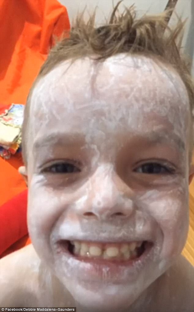 小男孩罹患嚴重濕疹身體奇癢，後來媽媽發現「這罐面霜」讓他奇蹟恢復光滑肌膚！