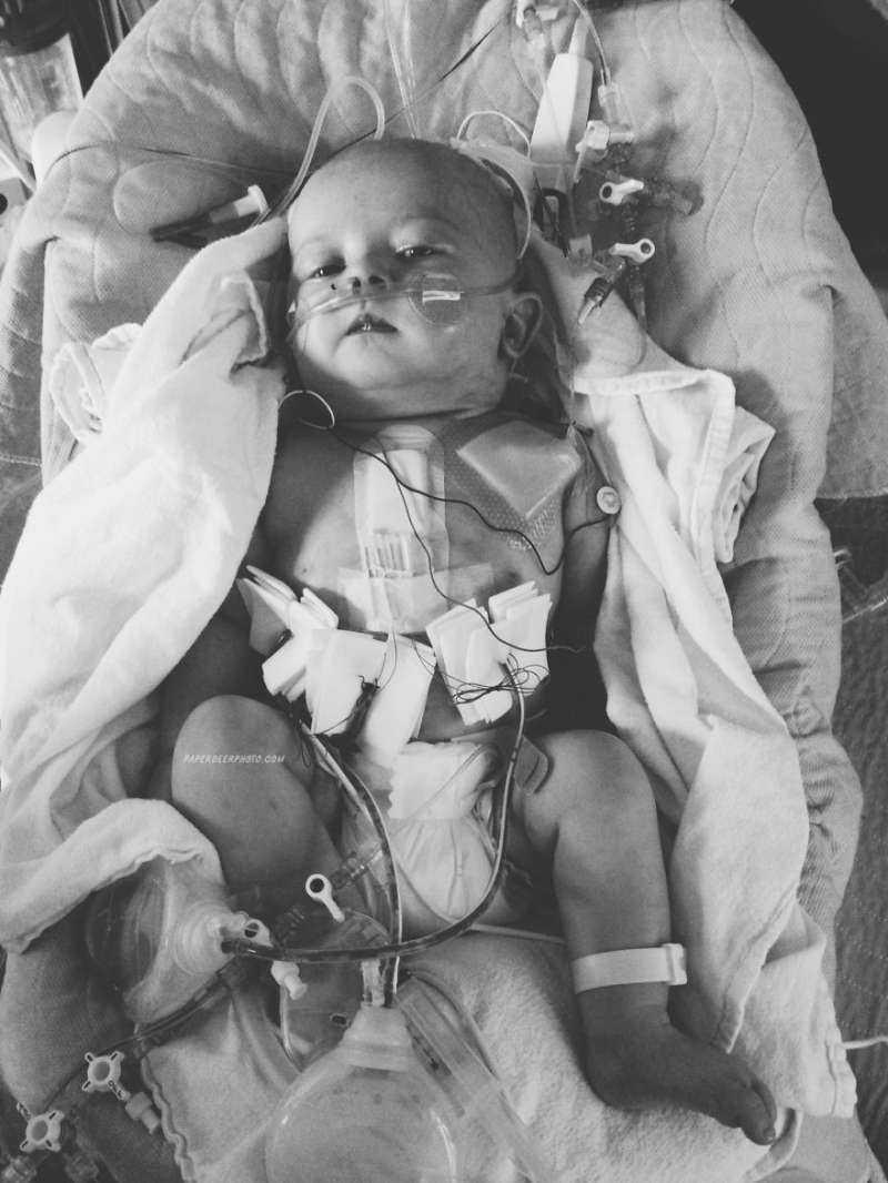 醫生曾預言活不過2週…　心臟病寶寶4年經歷「3次開心手術」　媽媽驚訝：他整個人都變了