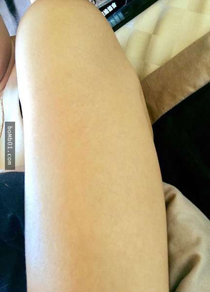 快檢查看看手臂上有沒有「卡介苗疤」，如果沒有的話你就是超稀少的幸運兒體質！