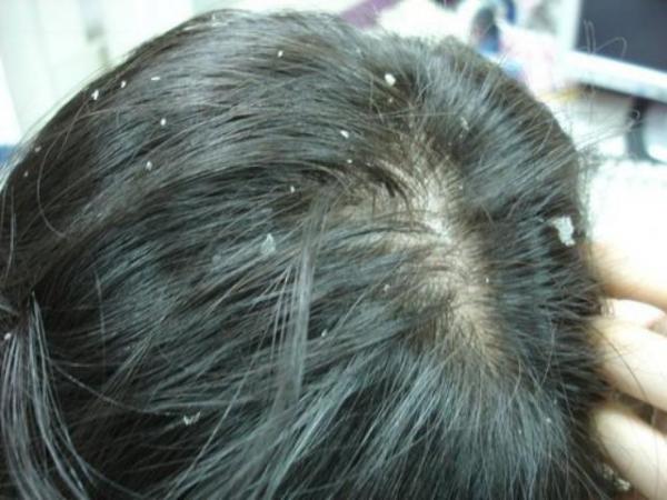 7種慢性自殺疾病讓大家「今天開始就不敢再頭髮濕濕地入睡」，想要癱瘓致死就繼續吧！