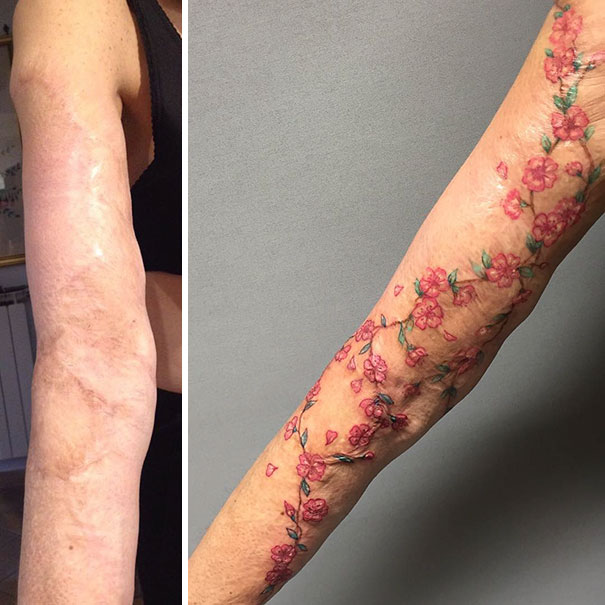 30個讓身體上有傷疤的人「可以感覺重生了」的療傷刺青！
