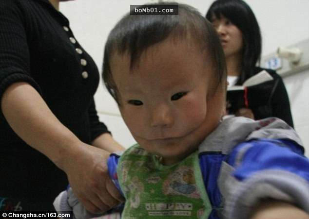 這個「面具娃娃」的故事現在連國際媒體都哭著報導，外國網友也心疼到替他集氣加油！