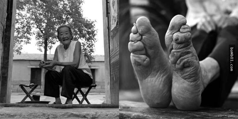 中國最後一批裹小腳女性「終於願意鬆開裹腳布」，親眼看到她們小腳的畸形程度後心都沉了下去…