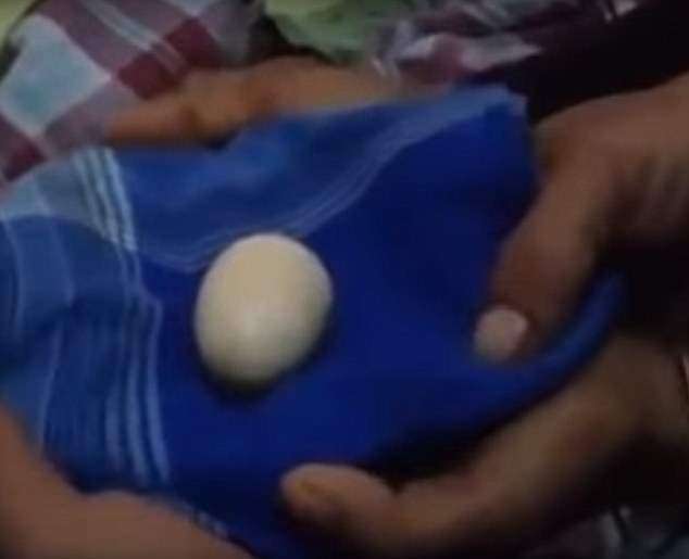 下蛋少年！　14歲的他2年產下20顆雞蛋　到醫生面前又擠出兩顆