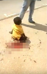 6歲男童過馬路時被卡車碾爆雙腿，腿上「只剩一層皮」讓人眼都哭紅了！