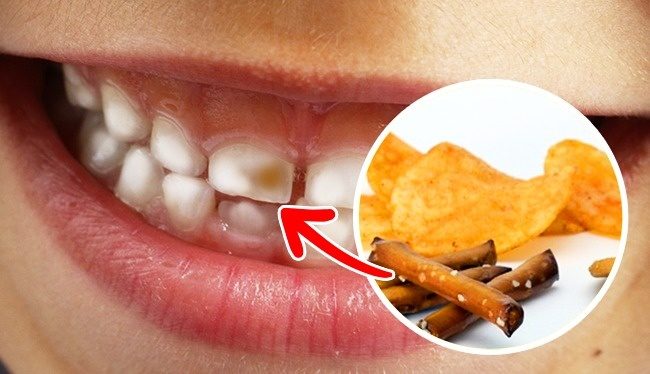 10種「台灣人都超愛吃，但是不知道吃太多會損害牙齒」的美味食物！