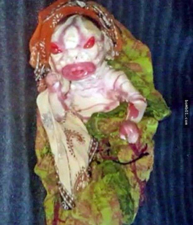 印度女嬰的「天生驚人外貌」被全村說是外星人，親生母親被嚇到連抱一抱她都不願意。