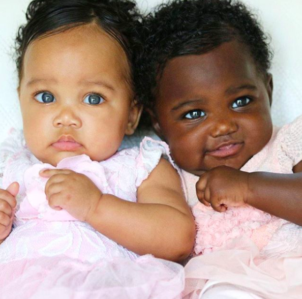 膚色不同的雙胞胎被酸民譏笑「黑檀木 VS 象牙白」，長大後那雙眼睛超迷人「每一秒都在放電」！