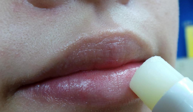 試用開架唇膏…女大生染「皰疹」急求醫　醫師：	要注意共用後果