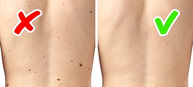身體在向你求救…8種「正在警告你身體已經生病了」的皮膚問題！