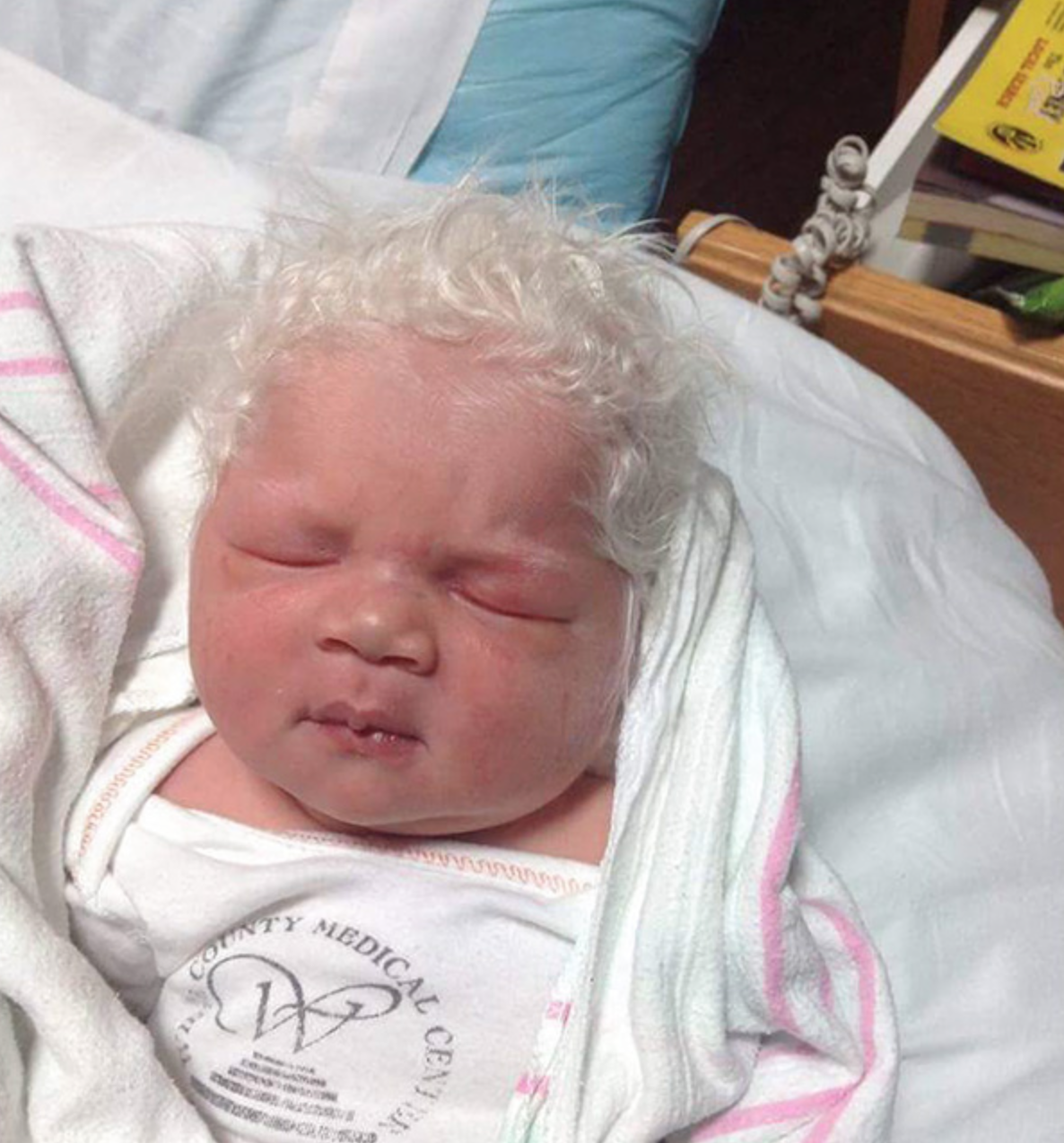 比少年白更早...嬰兒「天生銀白色髮絲」　醫生檢測後發現是人體奇蹟