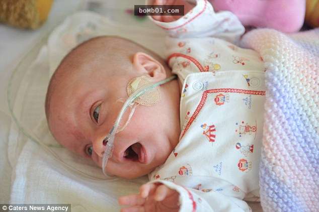 這個27週便早產出生的小寶寶連戒指都可以套進她手臂，被醫生斷言活不久的她最後竟然…