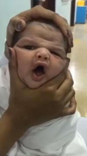 缺德護理師「玩嬰兒」！　寶寶的臉被壓到變形　她們卻笑到超大聲