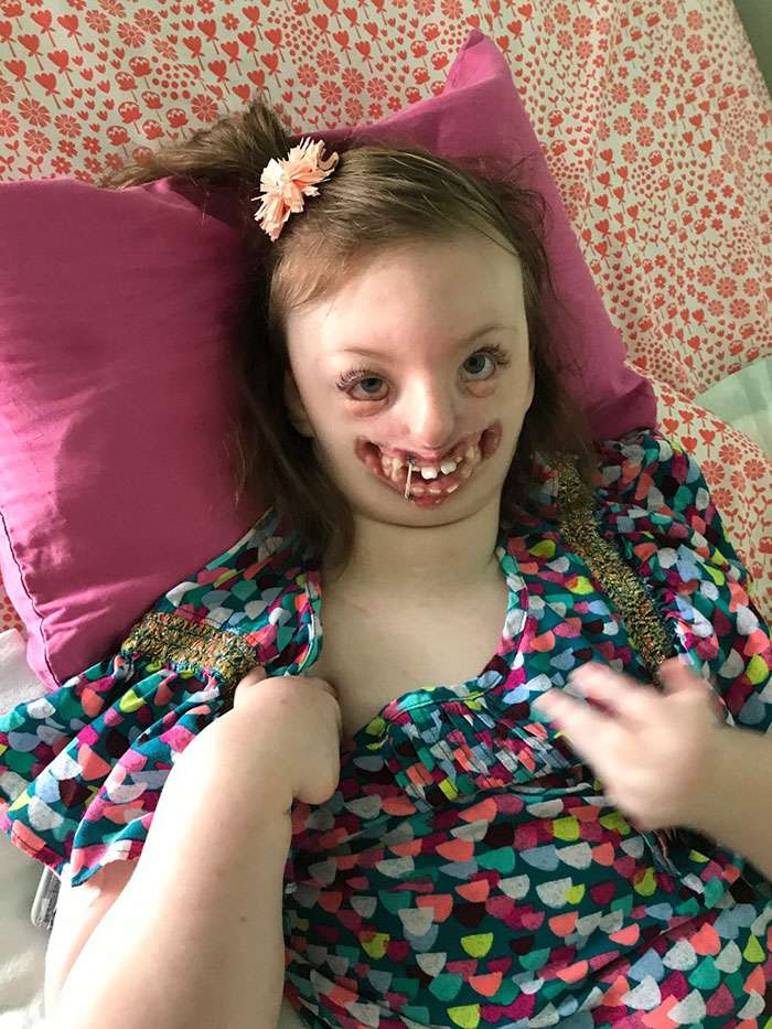 9歲殘疾女孩被網上狂罵「該墮了她」　媽媽施展「智慧反擊」讓他們都閉嘴了