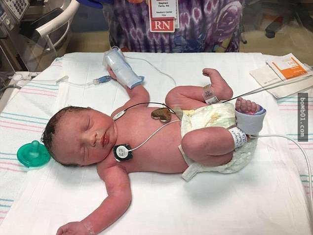 這個媽媽肚子裡的寶寶原本被醫生建議終止妊娠，但最後她竟神奇地「出生2次」還活了下來！