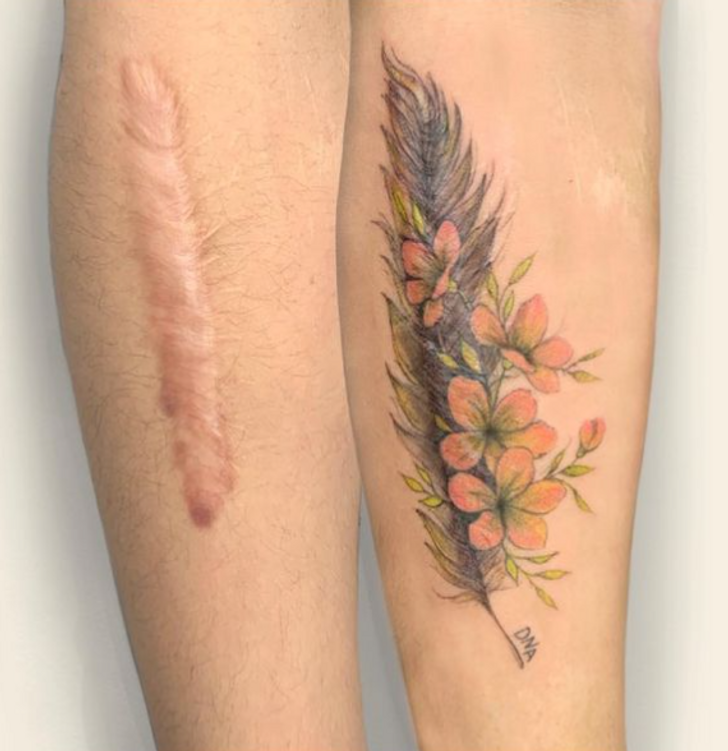 不用再遮了！刺青師將客人「自卑疤痕」轉化　「綻放出花朵」成個性印記