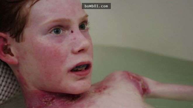 這位被稱為「蝴蝶兒童」的15歲男孩每次洗澡都會痛到尖叫，但這時候母親會強硬對他說…