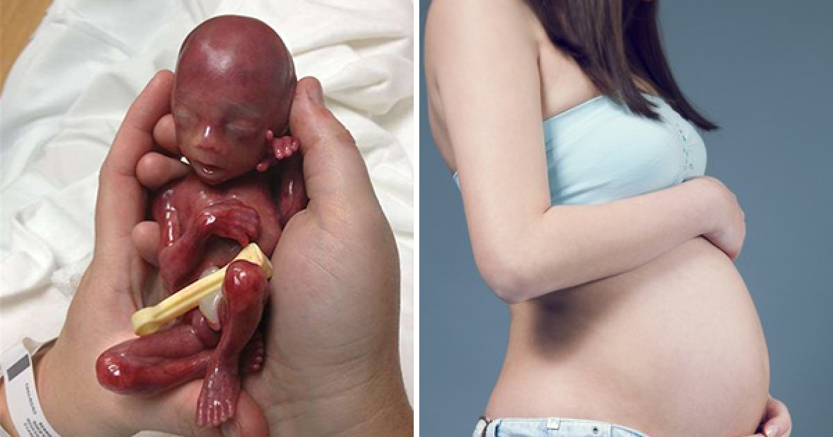 這個頭殼壞掉的懷孕少女為了讓下面「變緊」，竟然選擇狂抽菸和早產…