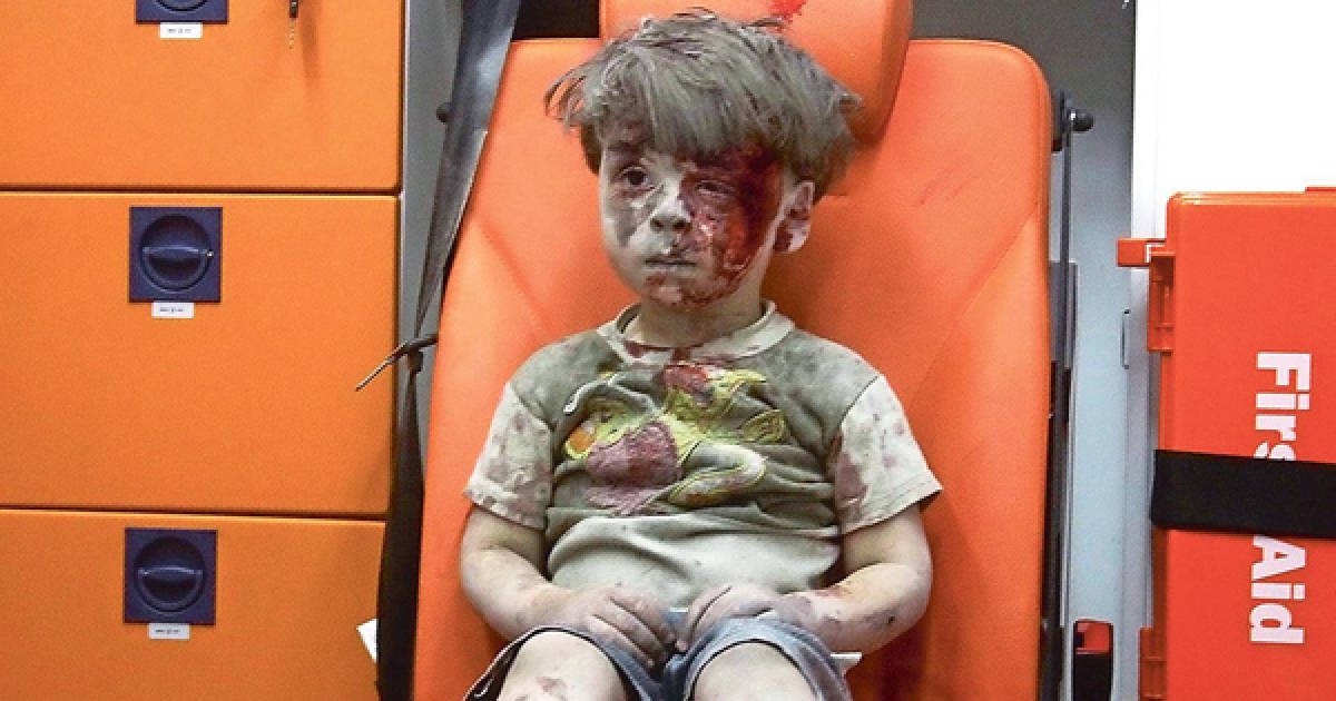 震撼全球的5歲敘利亞男孩「現在已經完全康復」，他現在的激萌模樣讓大家都放心了！