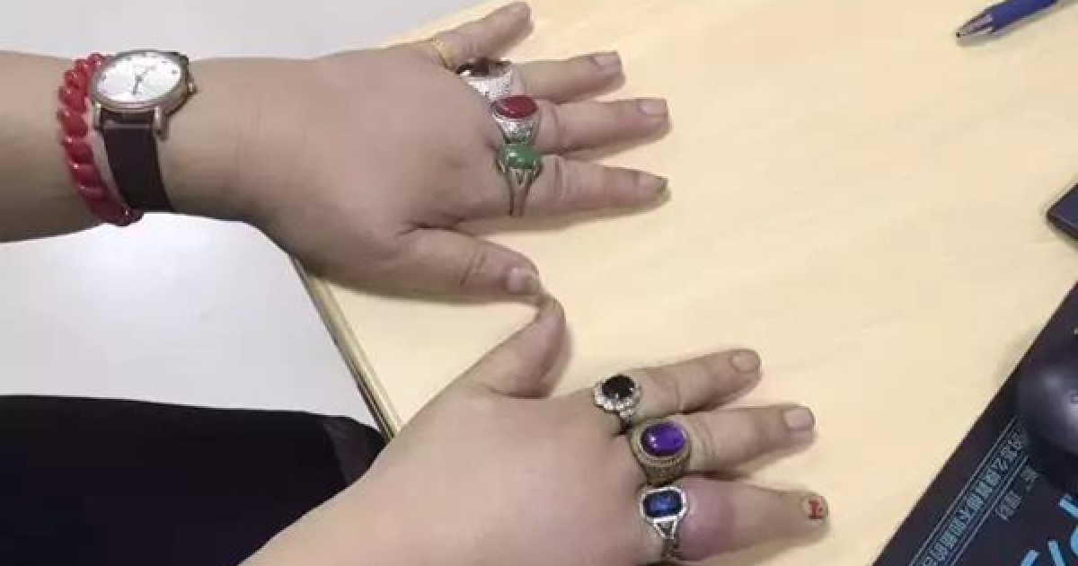 70歲強國大媽拿出戒指戴好戴滿9根手指，怎知卻卡住「最後還手指裂開」超驚悚！