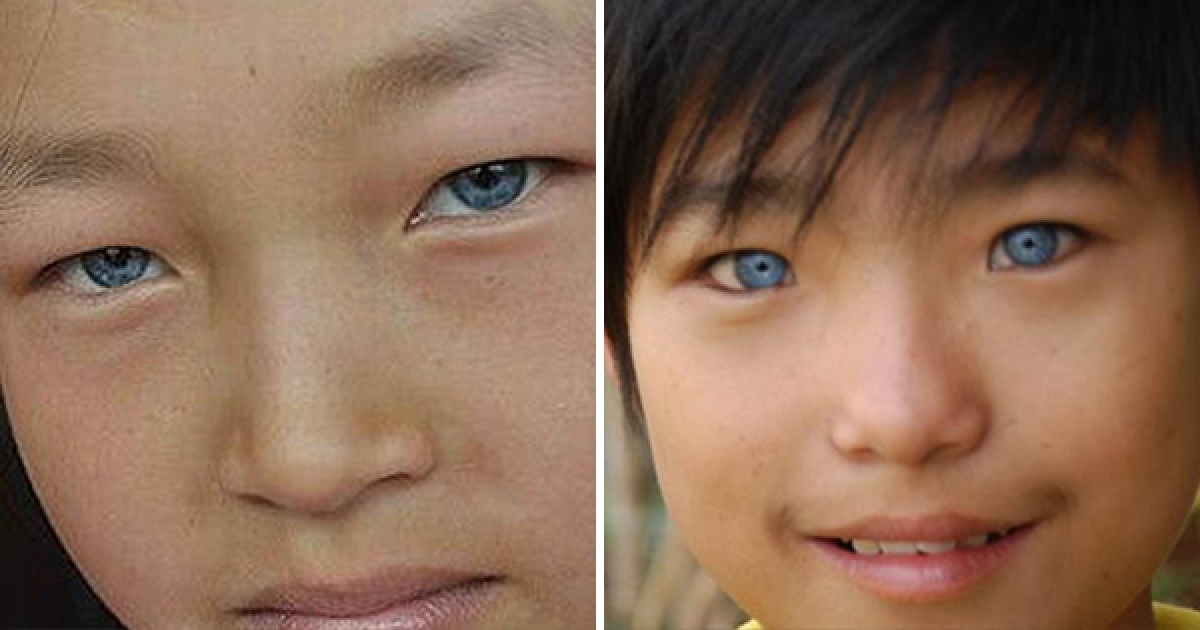 亞洲人也能有「藍眼睛」！醫學公司研發超狂新技術，20秒就能給你永久性的藍眼睛！