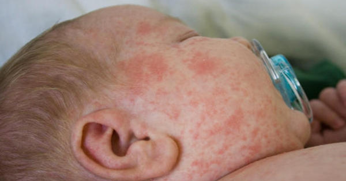 新生兒「高燒2天」就再也沒醒來！　最致命病菌「綠膿桿菌」就潛藏在我們生活中