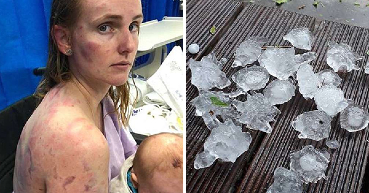 澳洲突爆砸冰雹雨！　勇母「以身護幼女」被砸到全身瘀傷